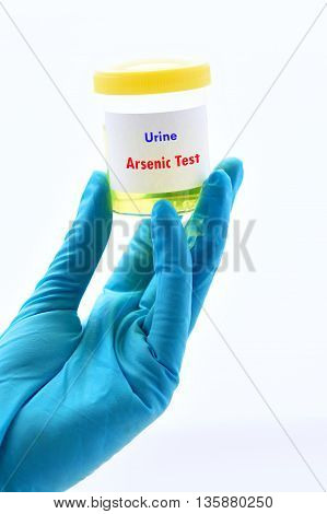 Urine sample for arsenic (Heavy metals) test