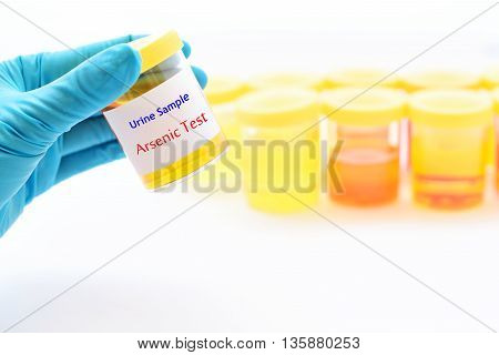 Urine sample for arsenic (Heavy metals) test