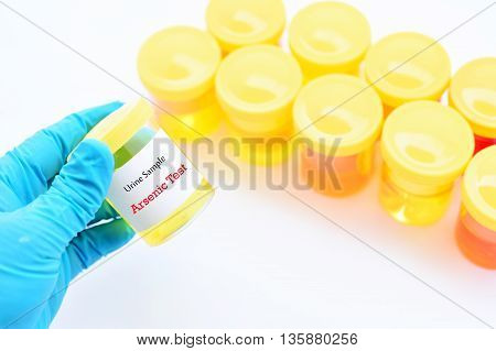 Urine sample for arsenic (Heavy metals) test