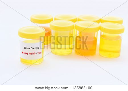 Cup with urine sample for heavy metals test