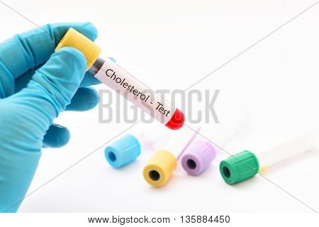 Test tube with blood sample for cholesterol test