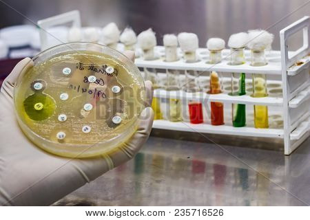 Side View Of Culture Plate Of Bacterial Growth Showing Antibiotic Sensitivity In Their Colony Patter