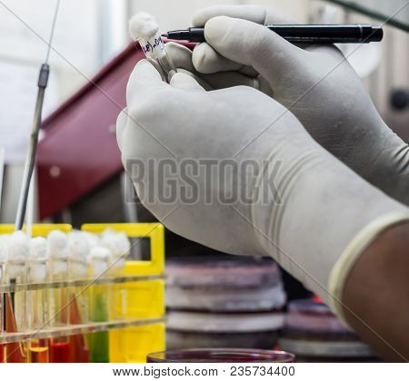 Test Tube Stand Showing Durham's Tube In Sugar Media Demonstrating Gas Production By Bacteria Held I