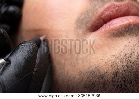 Male Trichopigmentation Service. Young Man Laying On The Back On The Esthetician Table. Master Hands