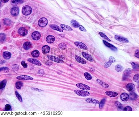 Tangential Section Of An Apocrine Sweat Gland Alveolus Showing The Elongated Shape Of Myoepithelial 