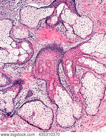 Sebaceous Gland Formed By Multiple Acinar Glands Surrounding A Central Hair Follicle To Which They S