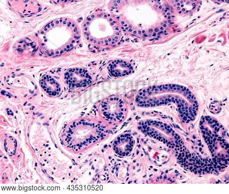 Comparison Between Secretory Units Of Apocrine (top) And Eccrine (bottom) Sweat Glands. In The Last 