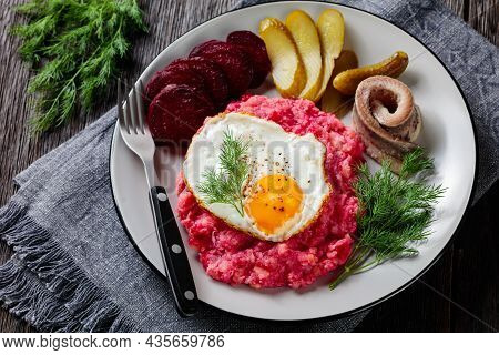 Labskaus, Corned Beef, Mashed Potatoes With The Beetroot Topped With Fried Eggs, Sliced Beets, With 