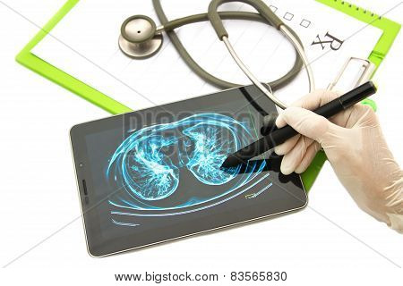 Doctor Looking Chest  X-ray Image On Tablet For Medical Exam