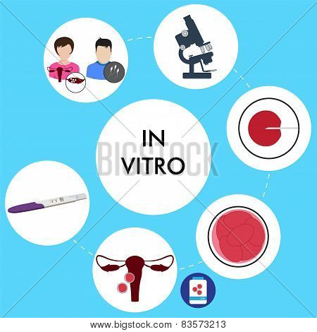 in vitro fertilization