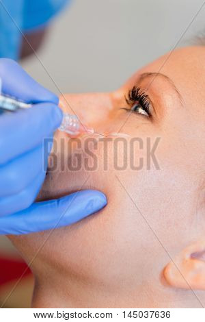 Hyaluronan injection filling, close up, vertical image