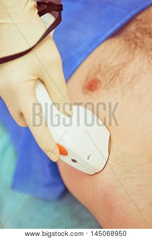 man receiving laser epilation at armpit on beauty center