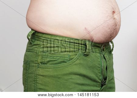 Weight gain due to improper diet. Fatty side and small pants