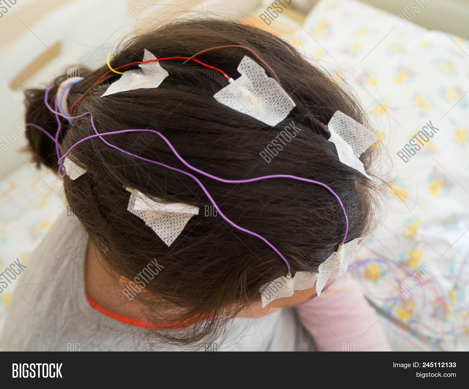 Girl Eeg Electrodes Image & Photo (Free Trial) Bigstock