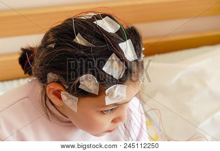 Girl With Eeg Electrodes Attached To Her Head