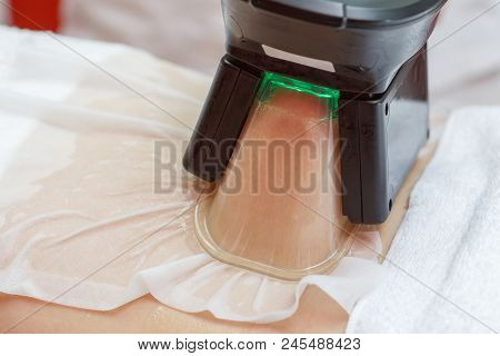 Woman Getting Cryolipolysis Fat Treatment Procedure In Professional Cosmetic Cabinet Or Spa Center, 