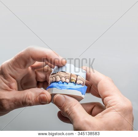 Technical Shots Of Model On A Dental Prothetic Laboratory. Dentist Hands With Model.