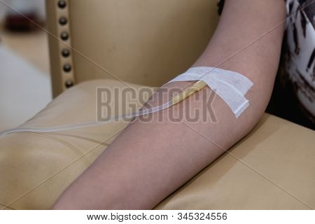 The Expert Is Piercing The Needle Into The Patient's Arm Sitting On A Yellow Leather Sofa Chair