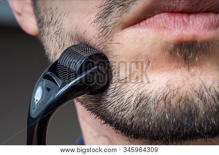 Facial Hair Care Concept. Young Man Is Using Derma Roller  On Beard.