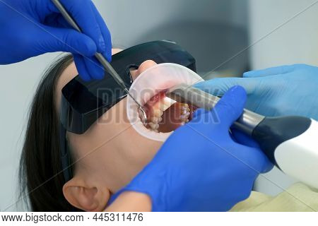 Dentist Is Doing Intraoral Scanning For Woman Before Installing Ceramic Veneers And Crowns. Orthodon