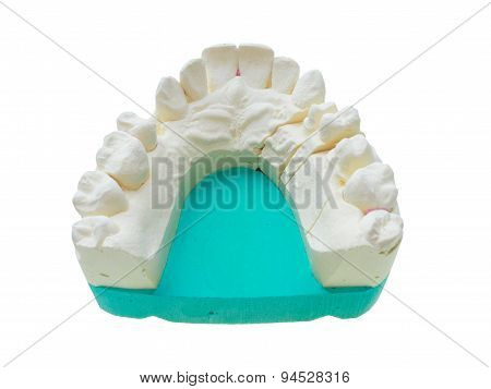 Positive Teeth Cast
