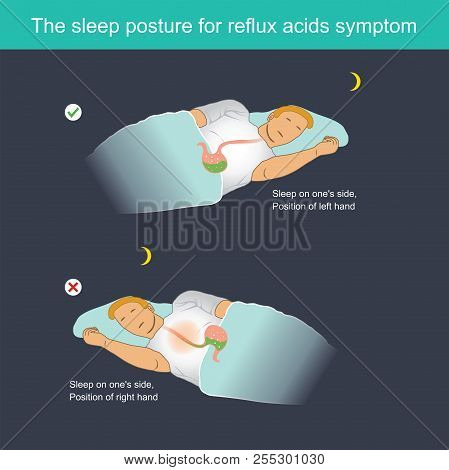 When Sleeping, Stomach Acid Can Flow Back To The Oesophagus, Causing A Burning Sensation In Chest Ce
