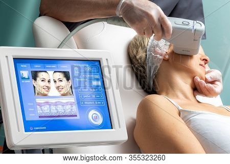 Middle Aged Woman Having Skin Tightening Ultrasound Treatment On Cheek. Digital Display On Hifu Equi