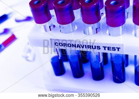 Coronavirus Blood Test Concept. Analyzing Blood Sample In Test Tube For Coronavirus Test. Test Tube