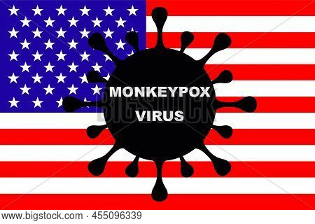 Monkeypox Virus. Flag Of Usa. Monkeypox Spain. Zoonotic Viral Disease That Can Infect Non-human Prim