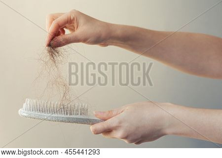 Hair Loss. Female Hand Pulls Out A Clump Of Hair From A Comb. Close-up. The Concept Of Alopecia And 