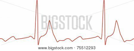 Sseamless ECG graph on white background