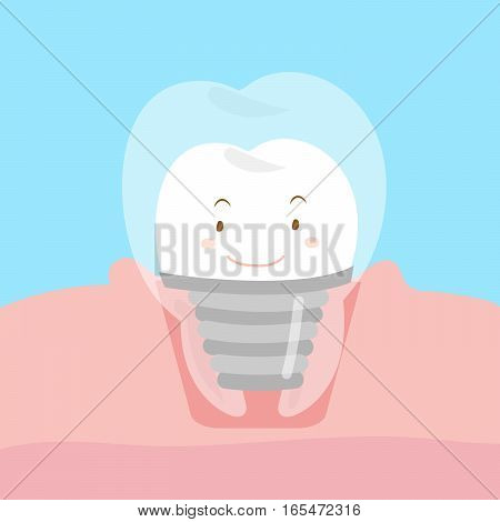 happy cute cartoon dental implants for your concept