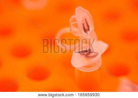 Close-up macro detail of two Polymerase Chain Reaction (PCR) tubes with labeled and open lids containing DNA from cancer cells on an orange plate. Cancer research and molecular biology concept.