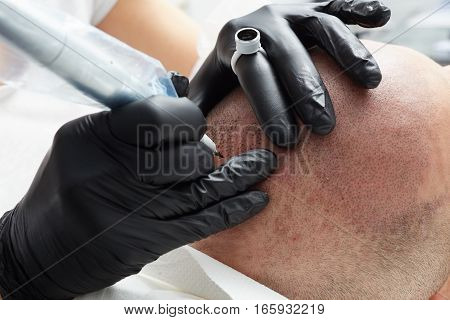 Cosmetologist making permanent makeup on male head - tricopigmentation