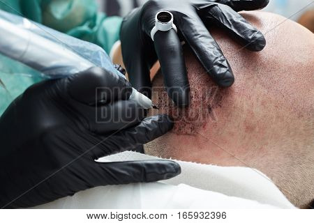 Cosmetologist making permanent makeup on male head - tricopigmentation