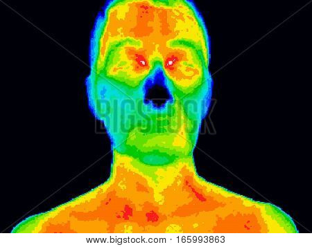 Thermographic image of a human face showing different temperatures in a range of colors from blue showing cold to red showing hot which can indicate inflammation.