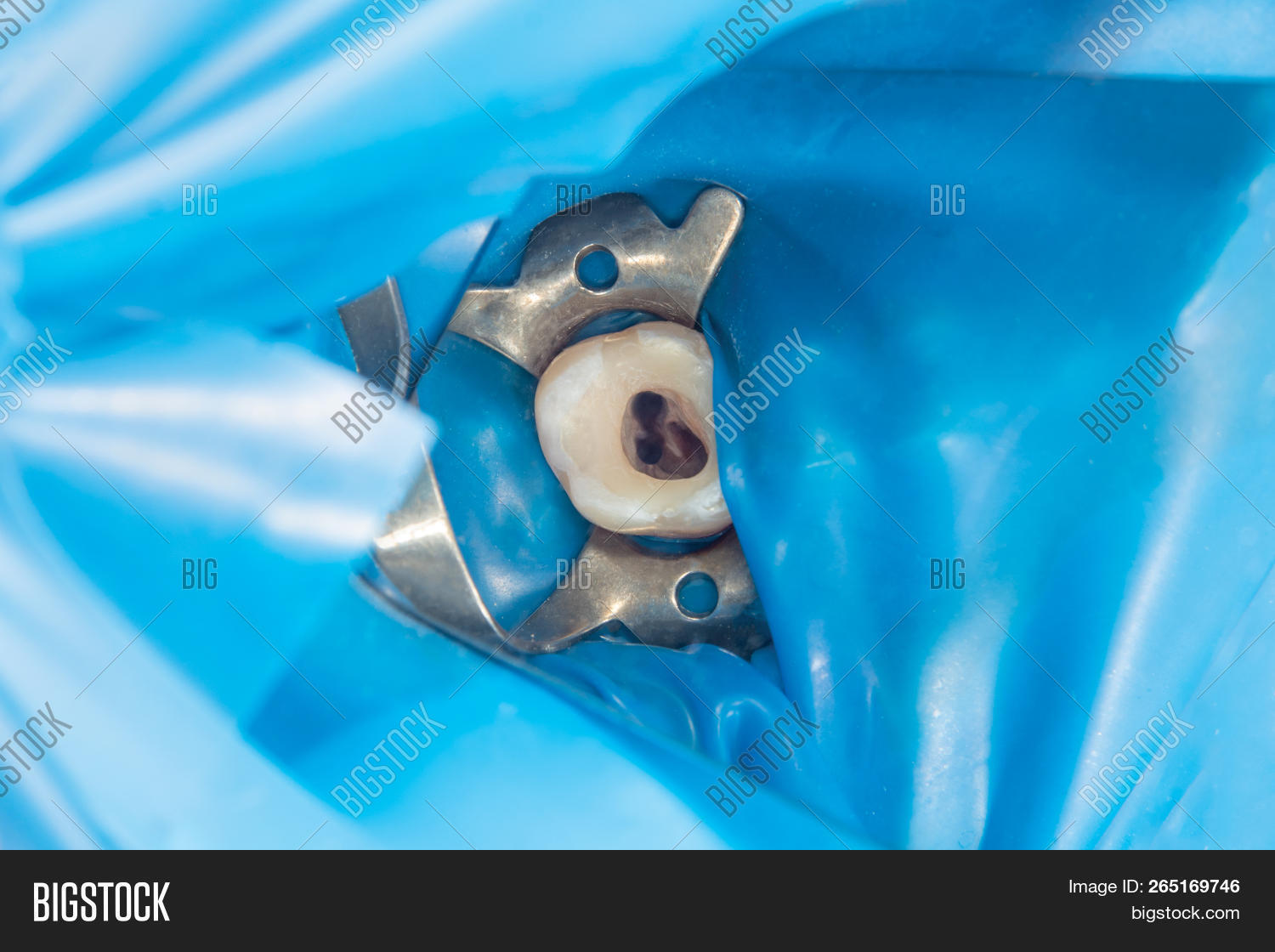 Two Sided Tooth Two Chewing Side Teeth Image & Photo (Free Trial) | Bigstock