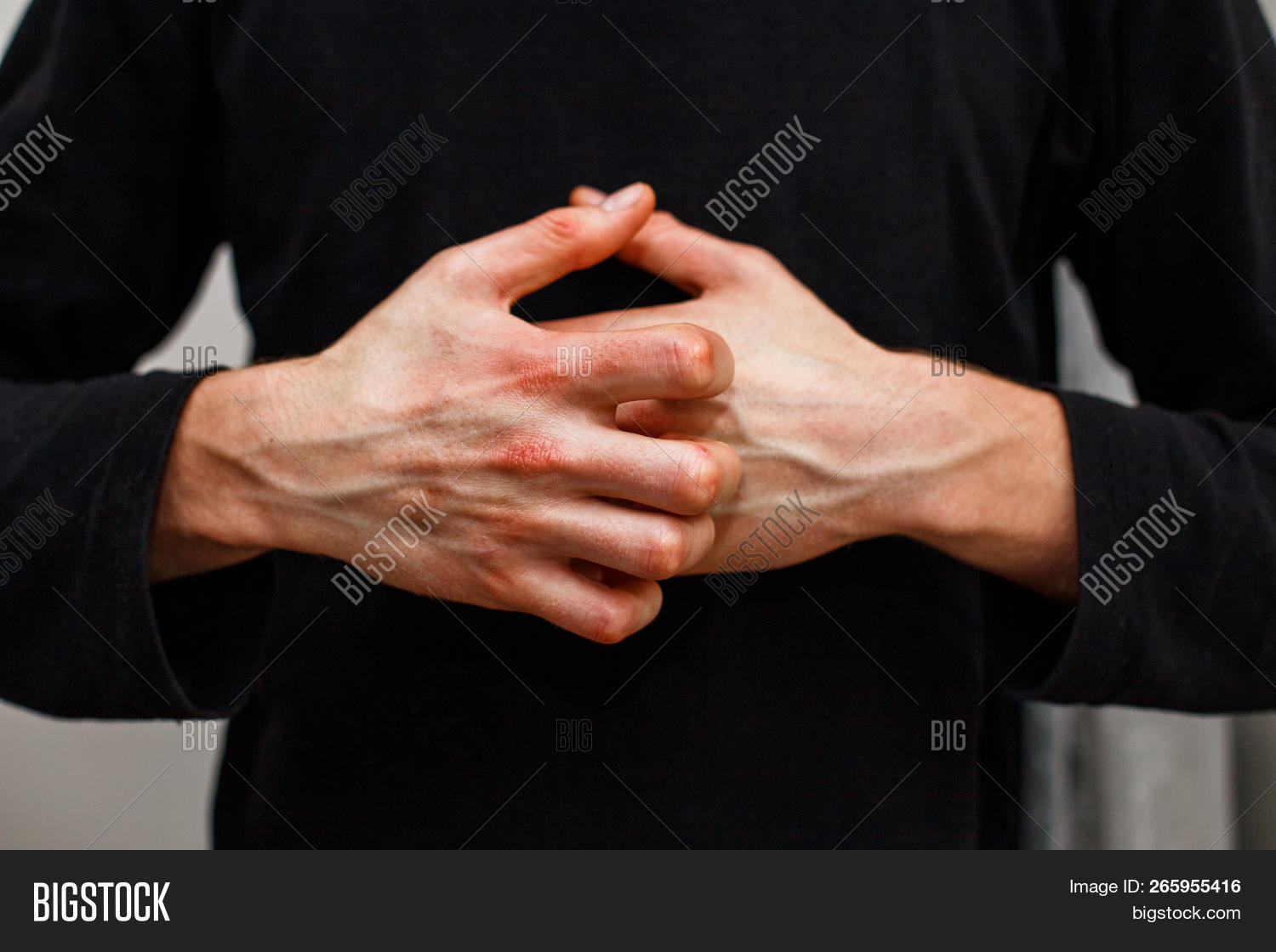 Man Scratch Oneself, Image & Photo (Free Trial) | Bigstock