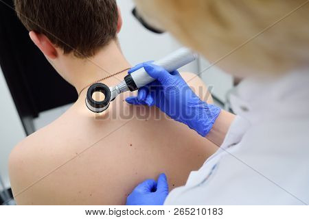 Method Of Dermatoscopy Of Skin Lesions And Moles.