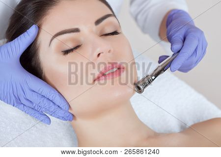 The Cosmetologist Makes The Microdermabrasion Procedure Of The Facial Skin Of A Beautiful, Young Wom