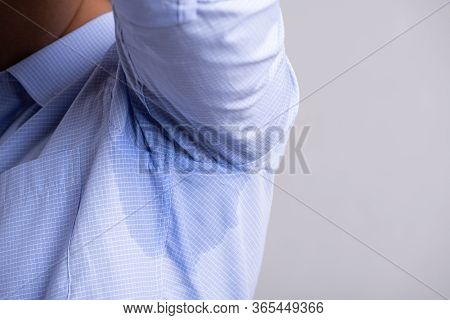 Close Up Asian Man With Hyperhidrosis Sweating. Young Asia Man With Sweat Stain On His Clothes Again