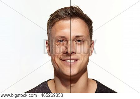 Mans Portrait In Comparison Youth And Maturity, Old Age. Skin Aging Process, Wrinkles. Plastic Surge