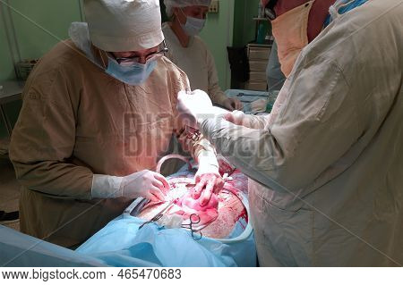 Ryazan, Russia - November 13, 2022: C-section. Surgeons In The Operating Room Perform A Caesarean Se