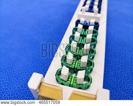 Closeup Image Of Lumbar Spinal Fusion Implant