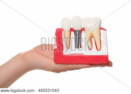 Dentist Holding Educational Model Of Dental Implant On White Background, Closeup