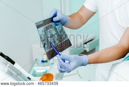 Hands Doctor Dentist In Gloves Show The Teeth On X-ray Foto In Dental Clinic On Light Background Wit