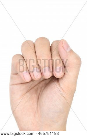 Small Lunulae Or Half-moons At Fingernails With Longitudinal Lines Of Southeast Asian, Chinese Young