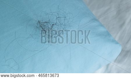 Fallen Long Hair On The Blue Pillow. Baldness And Hair Loss Problem