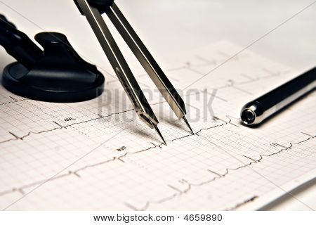 วิเคราะห์ Ecg
