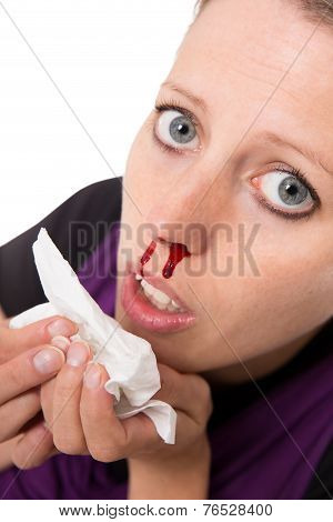 Young Woman With Bleeding Nose Isolated On White